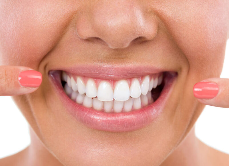 Dental crown