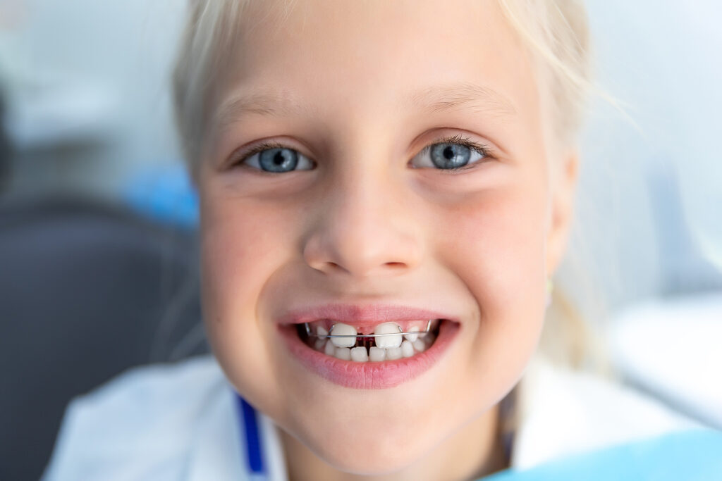 blond happy girl smiling showing diastema