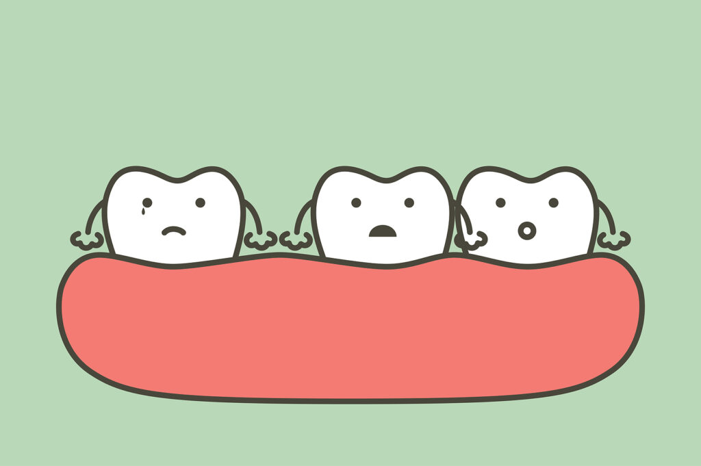 spacing teeth (diastema), dental problem