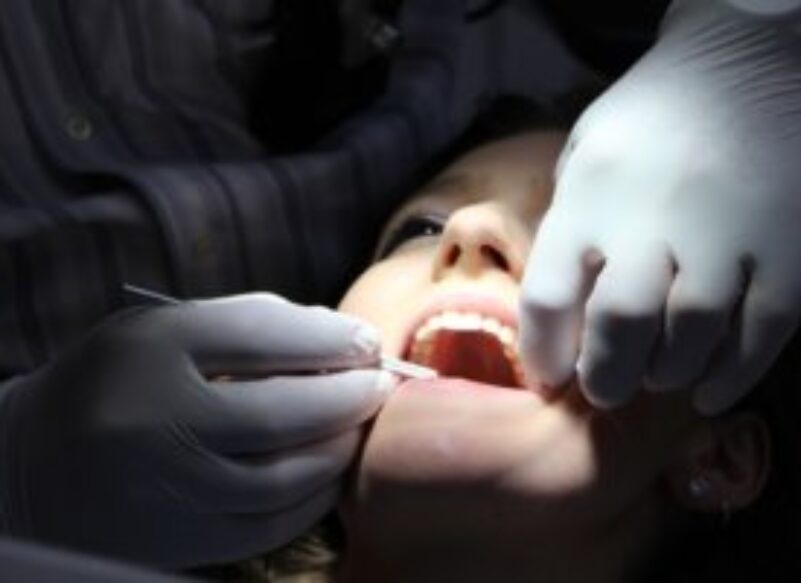blog thumb - Hove Dental Clinic