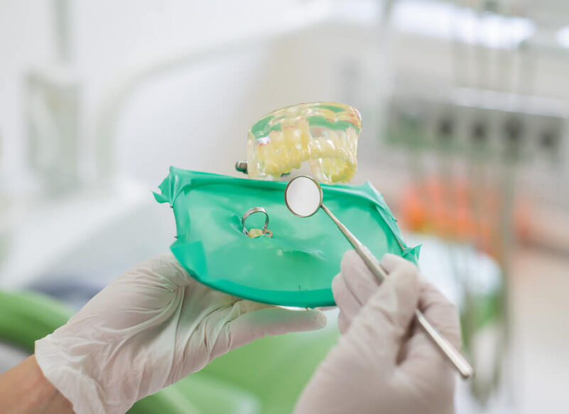 blog thumb - Hove Dental Clinic