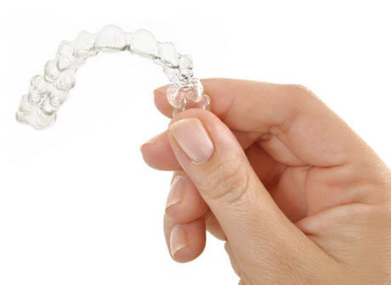 blog thumb - Hove Dental Clinic