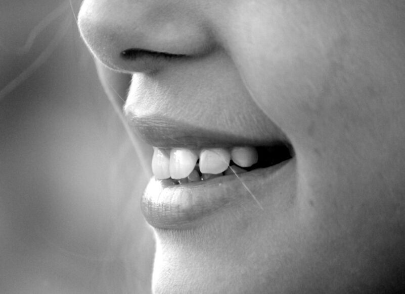 blog thumb - Hove Dental Clinic