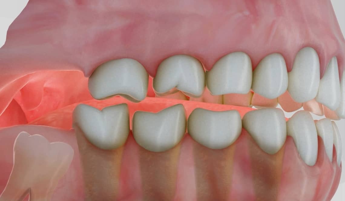 Treatment Preview Image