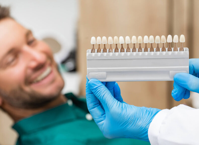 blog thumb - Hove Dental Clinic